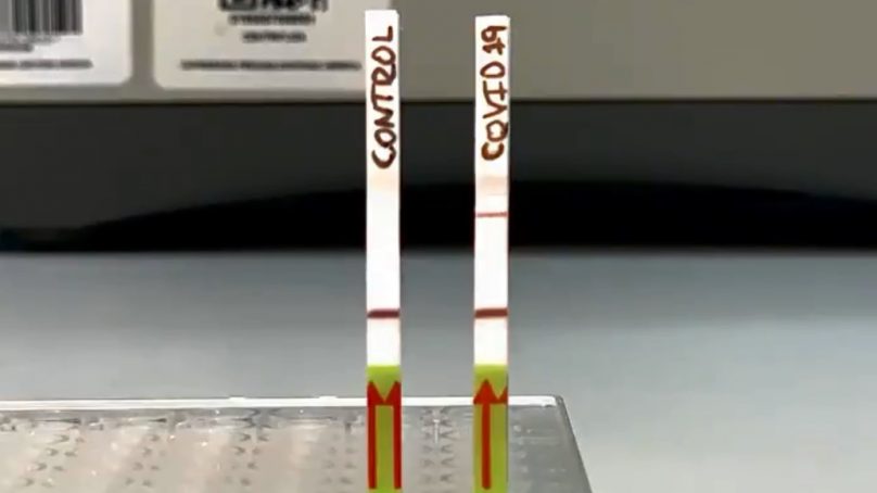 ¡Eureka! Científicos de la Cayetano Heredia crean prueba molecular «sin laboratorios costosos»